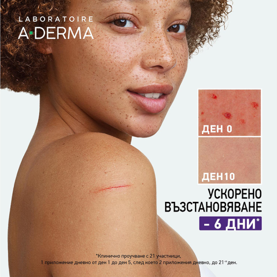 A-Derma Epitheliale Ultra Repair Възстановяващ крем срещу остатъчни следи 40ml