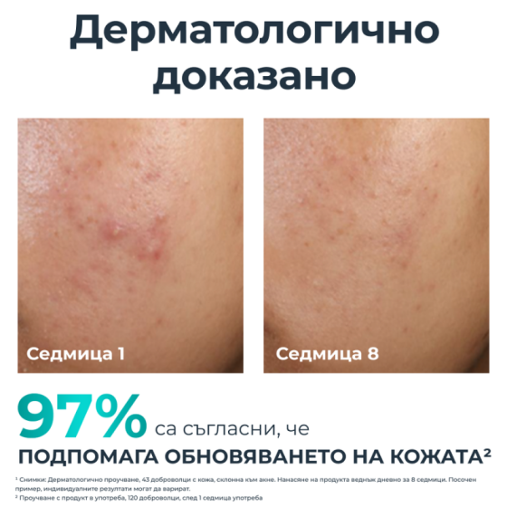 Eucerin Dermopure Clinical Peeling 10 Обновяваща нощна грижа за кожа, склонна към акне 40мл