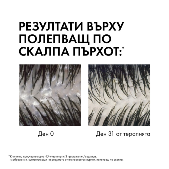 Vichy dercos шампоан против пърхот мазен скалп 390мл. 331290
